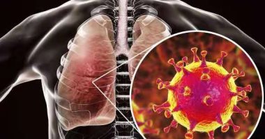 اليابان تعلن ارتفاع عدد المصابين بفيروس كورونا إلى 3 أشخاص