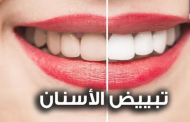 مفيدة أم ضارة.. حقيقة وصفات تبييض الأسنان